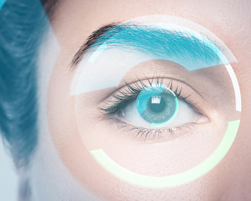Lasik_img2